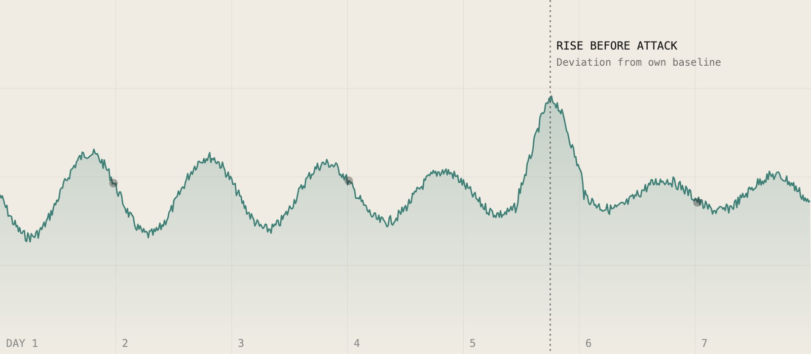 Continuous blood pressure trace showing a rise before a migraine attack